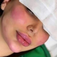 ** جشنواره تخفیفات بهاره تا خرداد *دکتر ابدال*|خدمات آرایشگری و زیبایی|اصفهان, ملک‌شهر|دیوار