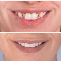 دندانپزشکی/ارتودنسی تخصصی|خدمات آرایشگری و زیبایی|تهران, خلیج فارس|دیوار
