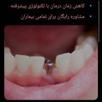 ایمپلنت  فوری.اوردنچر .عصب کشی ،ترمیم پوسیدگی|خدمات آرایشگری و زیبایی|تهران, تهرانپارس غربی|دیوار