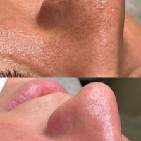 اخرین جایی ک برای پوستت میری اینجاست|خدمات آرایشگری و زیبایی|تهران, قلهک|دیوار