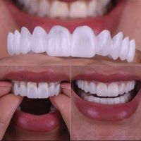 لمینت دندان و پرداخت درب منزل و|آرایشی، بهداشتی، درمانی|تهران, آجودانیه|دیوار