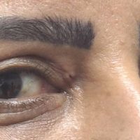بلفاروبلاستی پلک بالا و پایین....اقساطی|خدمات آرایشگری و زیبایی|اصفهان, خوراسگان|دیوار