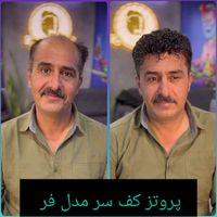 پروتزمو/ترمیم پروتزمو/روشی نوین جایگزین کاشت مو|خدمات آرایشگری و زیبایی|اصفهان, آفاران|دیوار