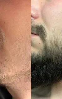 راز یک چهره جذاب