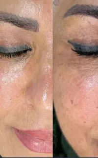 فشیال تخصصی و پاکسازی برای بانوان و آقایون