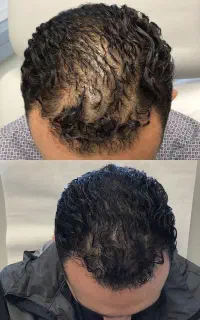 بزن موهات در بیاد