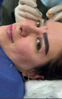 کلینیک تخصصی کاشت ابرو
