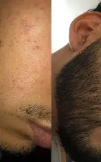 این اخرین روشیه که امتحان میکنی