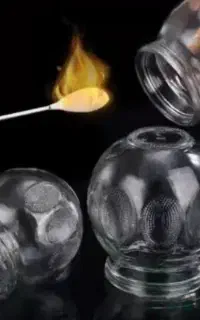 مرکز حجامت ، ماساژ  و بادکش درمانی