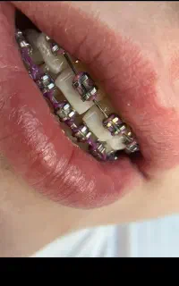 دندانپزشکی تخصصی ارتودنسی هرفک 20تومن