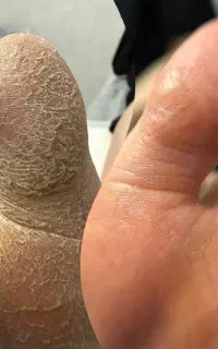 مژه کوتاهی کراتین اصلاح شمع رنگلایت