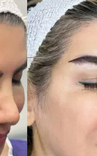 آفر میکروکاشت ابرو نقد و اقساط