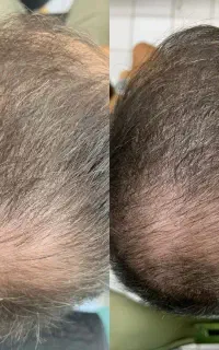 ازافسردگی نجاتت میدم