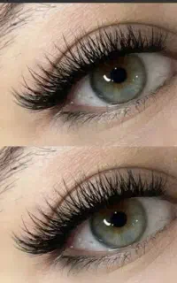 کاشت مژه ی هیدن