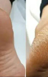 پدیکور و مانیکور پا جوانسازی دست