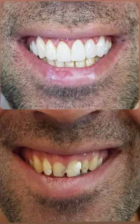 خدمات دندانپزشکی