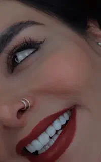 /کامپوزیت /لمینت / دنتال الماس