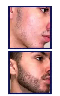 با پشمالویی که فاصله ای نداری