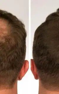 تار های ضعیف رو قوی تر کن