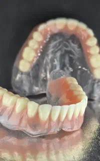 دندانسازی تخصصی پروتز دندان
