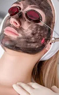 لیزر (روشن کننده بدن و صورت) پاکسازی جوانسازی صورت