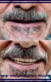 دندانپزشکی اقساطی بدون سود و بهره