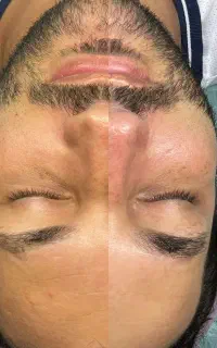 پاکسازی وفیشیال پوست خانوم وآقایان