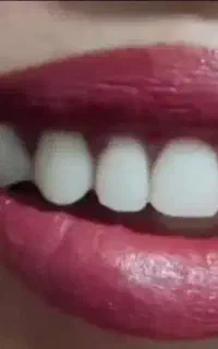 دندان مصنوعی یک روزه اقساط
