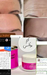 کرم بوتاکس دنا طب اصل شارژ شد