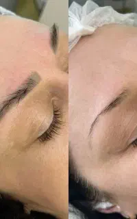 ریموو تک‌جلسه ای(پاک کردن تتو ابرو،لب و چشم )