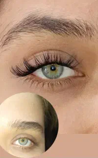 کاشت مژه هیدن