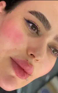 ژل لب تزریق فول فیس مدلینگ ۸۰۰
