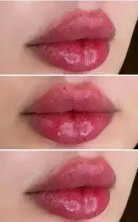 اف  ویژه فقط تا اخر هفته فول فیس  و ژل و بوتاکس