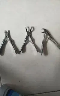 انبر