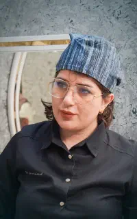 کاشت مو با تراکم بالا و کاشت شقیقه