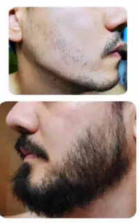 ریش داشته باش تا ریشه دار باشی