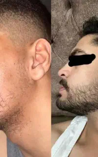 ریش داشته باش تا ریشه دار شوی