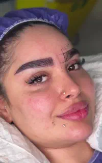 کاشت ابرو شیرازی فقط با ۱۰ تومن ،آف ویژه تابستان