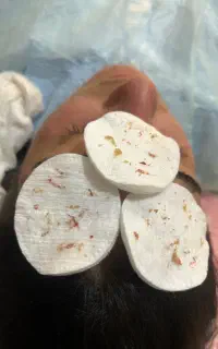 آموزش پاکسازی پوست