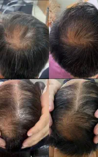 یک تار نازک یک علامت مهم