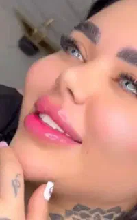 ژل-بوتاکس-فیلربادیپیرسینگ