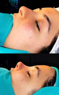 عمل لاغری و بینی با پزشکان متخصص با پایین ترین نرخ
