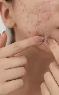 خدمات پوستی ، لک ، واریس ، جوش ، خال