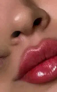 تزریق فیلر و بوتاکس توسط متخصص تخفیف ۵۰ درصدی