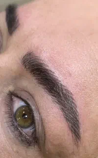 تخفیف در میکروبلیدینگ