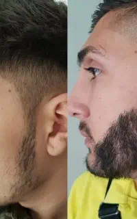 هرچی پرپشت تر جذاب تر