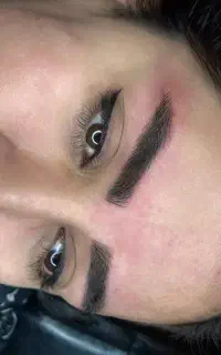 نماینده فی فیبروزمیکروبلیدهاشورشیدلب بن مژه تتو
