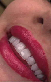 کامپوزیت اقساطی با ده سال گارانتی و پالیش رایگان