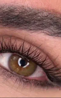 کاشت مژه فقط هزینه مواد رومیگیرم