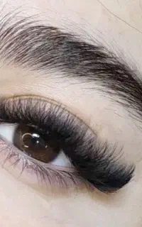 کاشت مژه